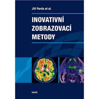 Inovativní zobrazovací metody (978-80-749-2186-5)