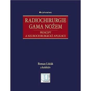 Radiochirurgie gama nožem (978-80-247-2350-1)