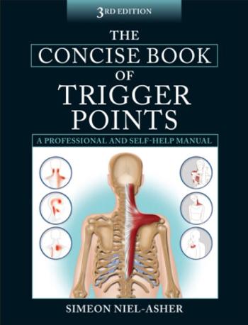 The Concise Book of Trigger Points - Simeon Niel-Asher