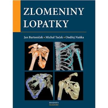 Zlomeniny lopatky (978-80-7345-690-0)