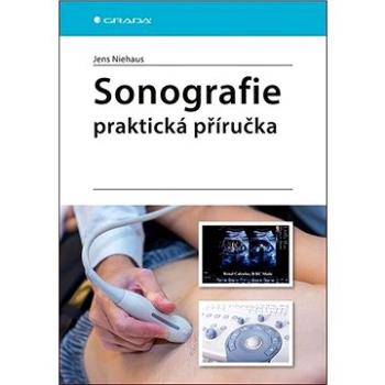 Sonografie Praktická příručka (978-80-271-2468-8)