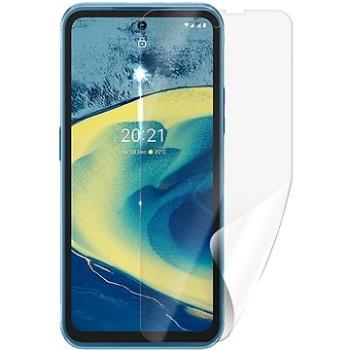 Screenshield NOKIA XR20 5G fólie na displej (NOK-XR205G-D)