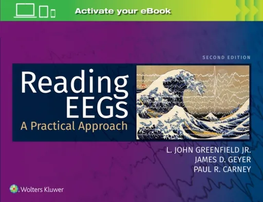 Reading EEGs: A Practical Approach - James D. Geyer, Paul R. Carney, L. John Greenfield