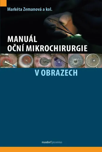 Manuál oční mikrochirurgie v obrazech - kolektiv autorů, Markéta Zemanová