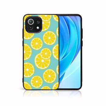 MY ART Ochranný kryt Xiaomi Mi 11 Lite / 11 Lite 5G / 11 Lite NE 5G -LEMON (121)