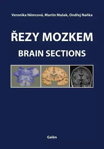 Řezy mozkem / Brain Sections - Ondřej Naňka, Martin Mašek, Veronika Němcová