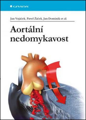 Aortální nedomykavost - Jan Vojáček, Pavel Žáček, Jan Dominik