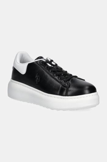 Dětské sneakers boty U.S. Polo Assn. MEGHAN003K/DY1 černá barva, MEGHAN003