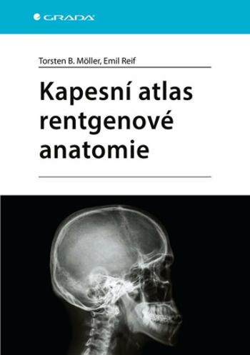 Kapesní atlas rentgenové anatomie - Torsten B. Möller, Emil Reif