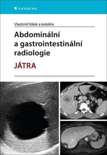 Abdominální a gastrointestinální radiologie - Vlastimil Válek