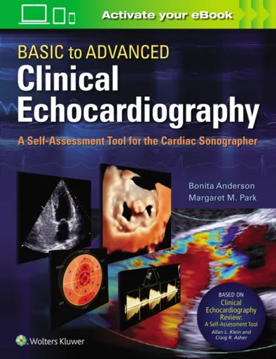 Basic to Advanced Clinical Echocardiography - Bonita Anderson, Margaret M. Park