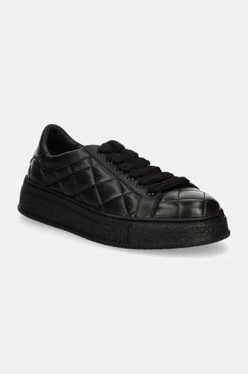 Sneakers boty AGL Giuly Matelasse černá barva, D946002PGKA0761013