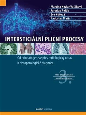 Intersticiální plicní procesy - Jaroslav Polák, Radoslav Matěj, Eva Kočová, Martina Koziar Vašáková