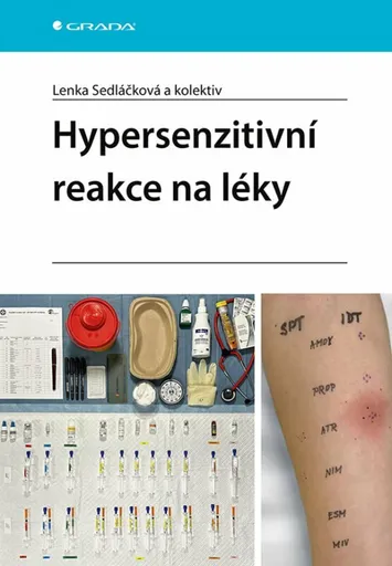 Hypersenzitivní reakce na léky - Lenka Sedláčková
