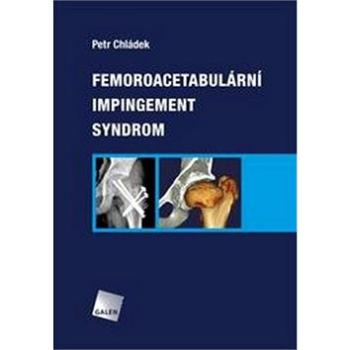 Femoroacetabulární impingement syndrom (978-80-7492-251-0)