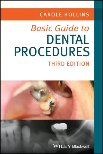 Basic Guide to Dental Procedures - Carole  Hollins