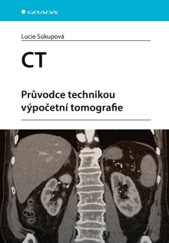 CT - Průvodce technikou výpočetní tomografie - Lucie Súkupová - e-kniha