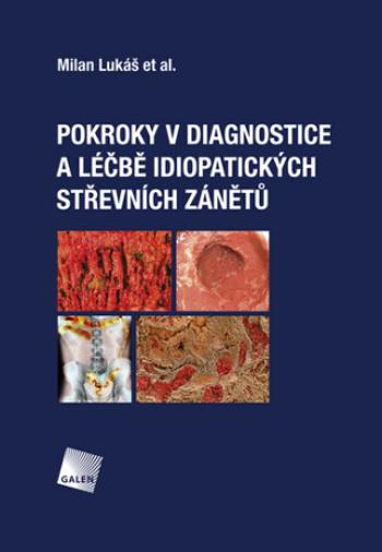 Pokroky v diagnostice a léčbě idiopatických střevních zánětů - Milan Lukáš