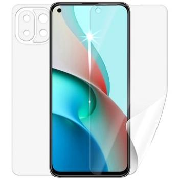 Screenshield pro XIAOMI Mi 11 Lite 5G na celé tělo (XIA-MI11LT5G-B)