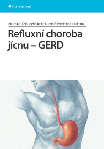 Refluxní choroba jícnu - GERD - Vela Marcelo F., Richter Joel E., John E. Pandolfino - e-kniha