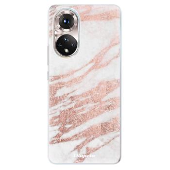 Odolné silikonové pouzdro iSaprio - RoseGold 10 - Honor 50