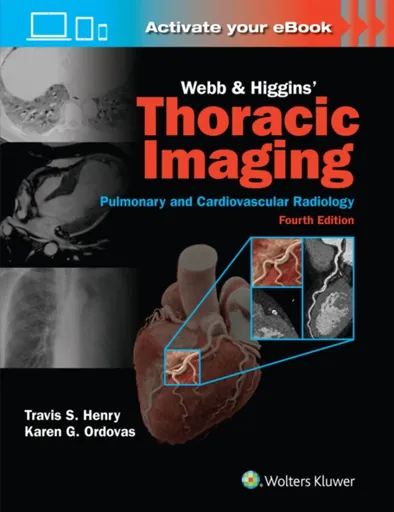 Webb & Higgins Thoracic Imaging: Print + eBook with Multimedia - KAREN GOMES, MD, MAS ORDOVAS, Travis Scott, MD Henry
