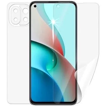 Screenshield pro XIAOMI Mi 11 Lite 5G na celé tělo (XIA-MI11LT5G-B)