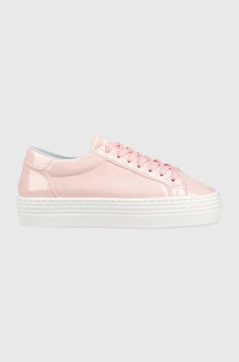 Sneakers boty Chiara Ferragni Tennis Low růžová barva, CF TENNIS LOW