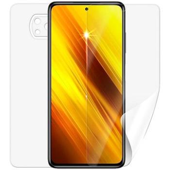 Screenshield POCO X3 Pro na celé tělo (XIA-POCOX3PR-B)