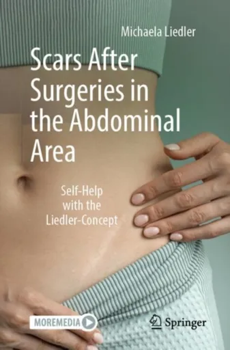 Scars After Surgeries in the Abdominal Area - Michaela Liedler
