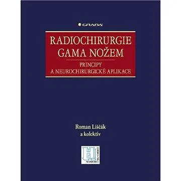 Radiochirurgie gama nožem (978-80-247-2350-1)