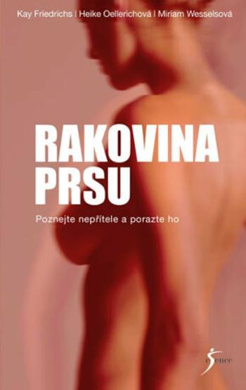 Rakovina prsu - Miriam Wessels, Kay Friedrichs, Oellerichová Heike