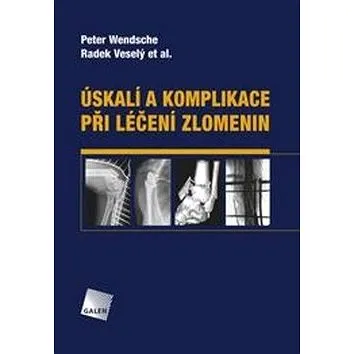 Úskalí a komplikace při léčení zlomenin (978-80-7492-393-7)