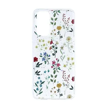 TopQ Kryt Glitter Xiaomi Redmi Note 11 Rozkvetlá louka 94638 (94638)