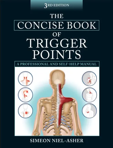 The Concise Book of Trigger Points - Simeon Niel-Asher