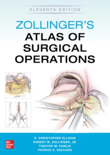 Zollinger's Atlas of Surgical Operations, Eleventh Edition - E. Ellison, Timothy Pawlik, Robert Zollinger, Patrick Vaccaro