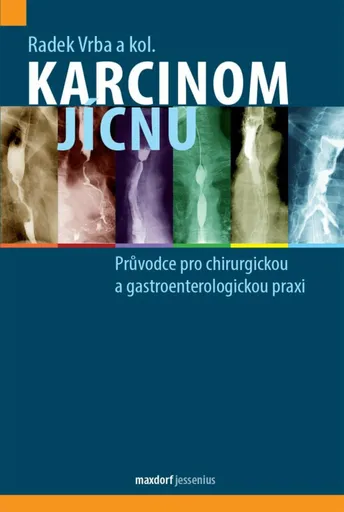 Karcinom jícnu - kolektiv autorů, Vrba Radek