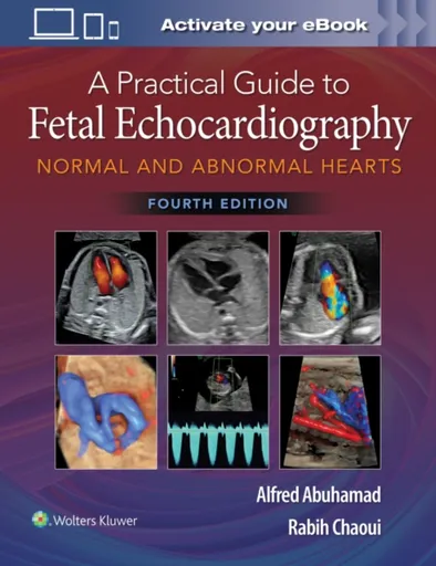 A Practical Guide to Fetal Echocardiography - Alfred Z. Abuhamad, Rabih Chaoui