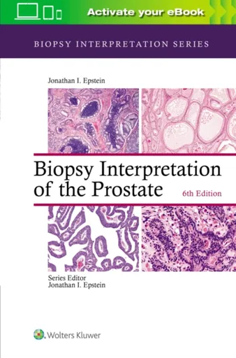 Biopsy Interpretation of the Prostate - Jonathan I. Epstein