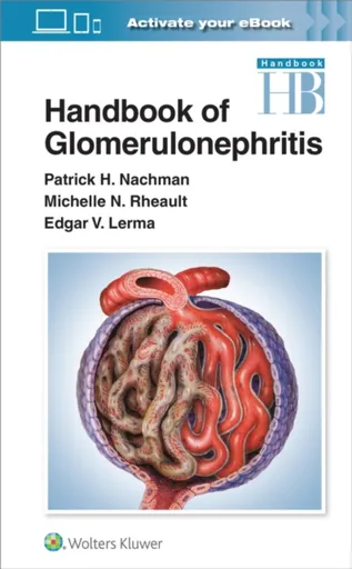 Handbook of Glomerulonephritis - Edgar Lerma, Patrick Henry Nachman, Michelle Rheault