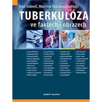 Tuberkulóza ve faktech i obrazech (978-80-7345-613-9)